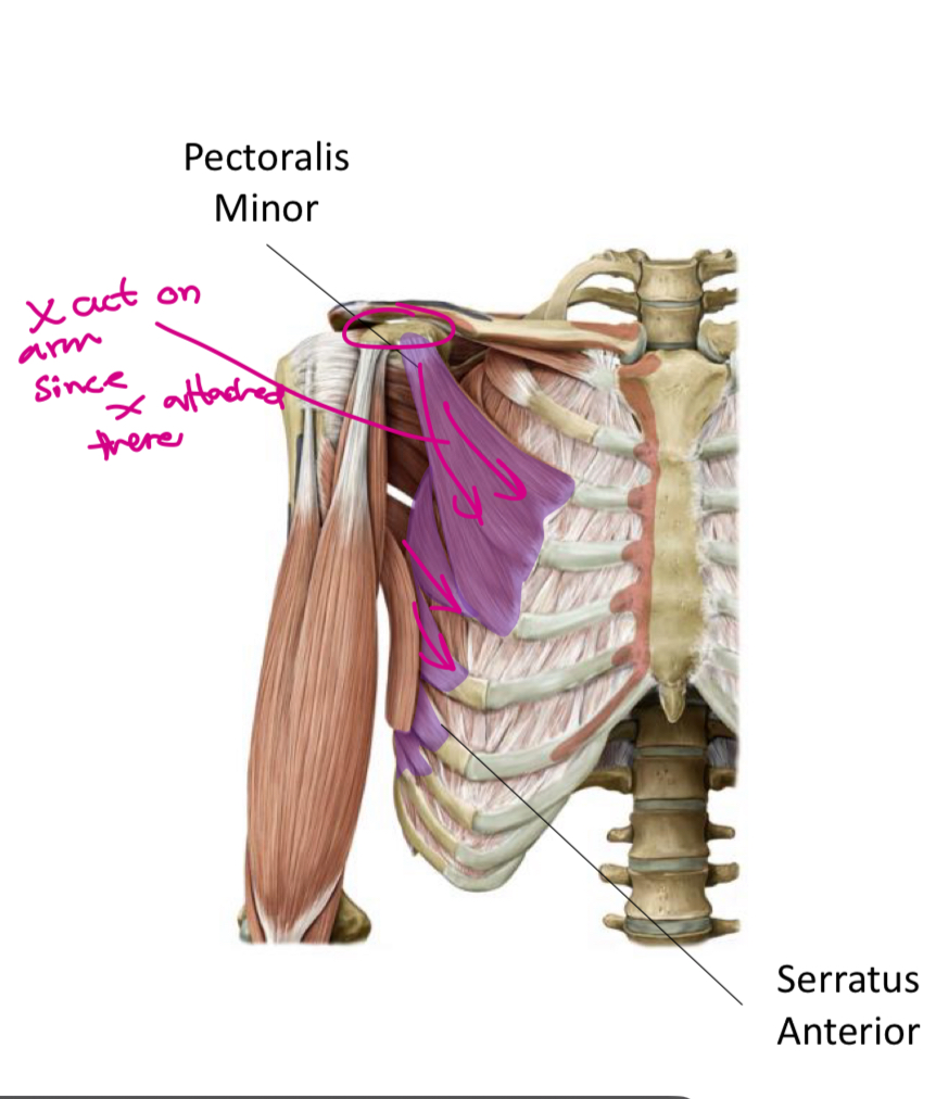 <p>Innervation: <strong>Medial Pectoral N</strong></p><p>Function: <strong>Scapular protraction + Stabilization </strong></p>