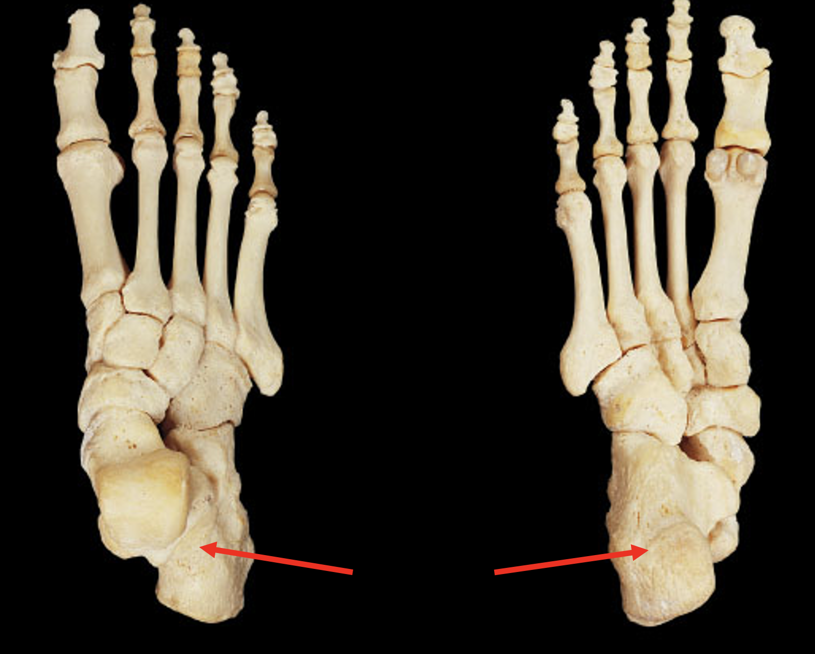 <p>Name this region of the foot</p>