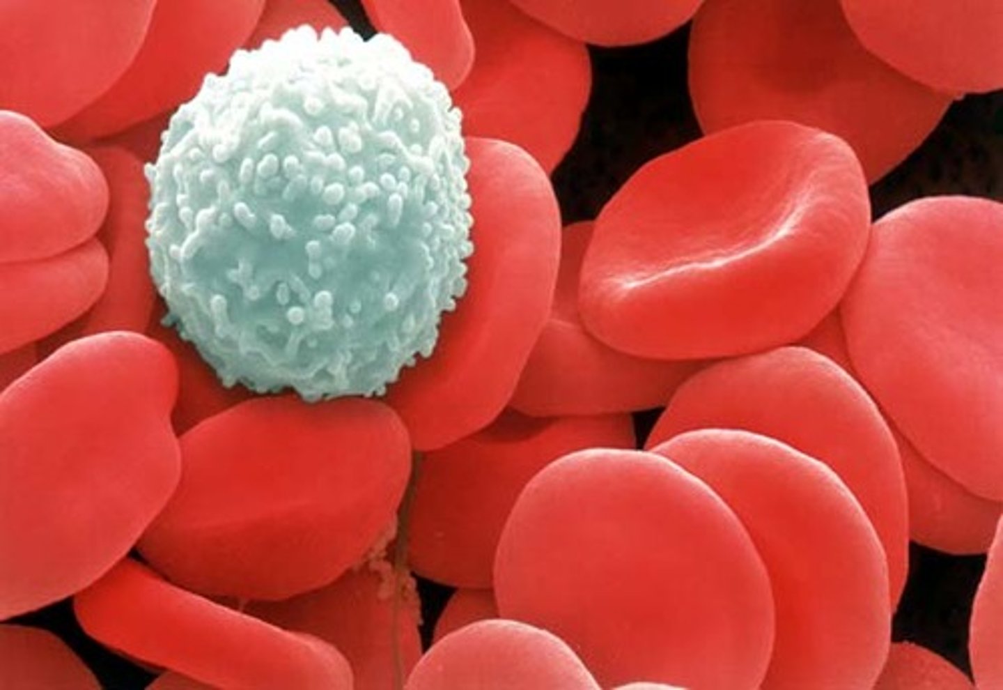 <p>White blood cells</p>