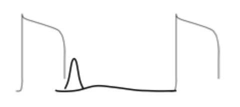 <p>(1) what does this diagram represent?</p><p>(2) how many action potential are present?</p><p>(3) how many heart beats are present? </p>
