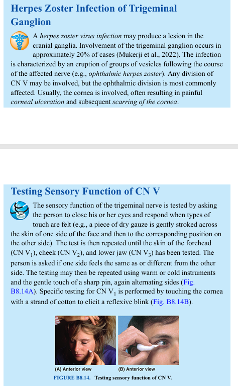 <p>Herpes Zoster Infection of Trigeminal Ganglion A herpes zoster virus infection may produce a lesion in the cranial ganglia. Involvement of the trigeminal ganglion occurs in approximately 20% of cases (Mukerji et al., 2022). The infection is characterized by an eruption of groups of vesicles following the course of the affected nerve (e.g., ophthalmic herpes zoster). Any division of CN V may be involved, but the ophthalmic division is most commonly affected. Usually, the cornea is involved, often resulting in painful corneal ulceration and subsequent scarring of the cornea. Testing Sensory Function of CN V The sensory function of the trigeminal nerve is tested by asking the person to close his or her eyes and respond when types of touch are felt (e.g., a piece of dry gauze is gently stroked across the skin of one side of the face and then to the corresponding position on the other side). The test is then repeated until the skin of the forehead (CN V1), cheek (CN V2), and lower jaw (CN V3) has been tested. The person is asked if one side feels the same as or different from the other side. The testing may then be repeated using warm or cold instruments and the gentle touch of a sharp pin, again alternating sides (Fig. B8.14A). Specific testing for CN V1 is performed by touching the cornea with a strand of cotton to elicit a reflexive blink (Fig. B8.14B)</p>