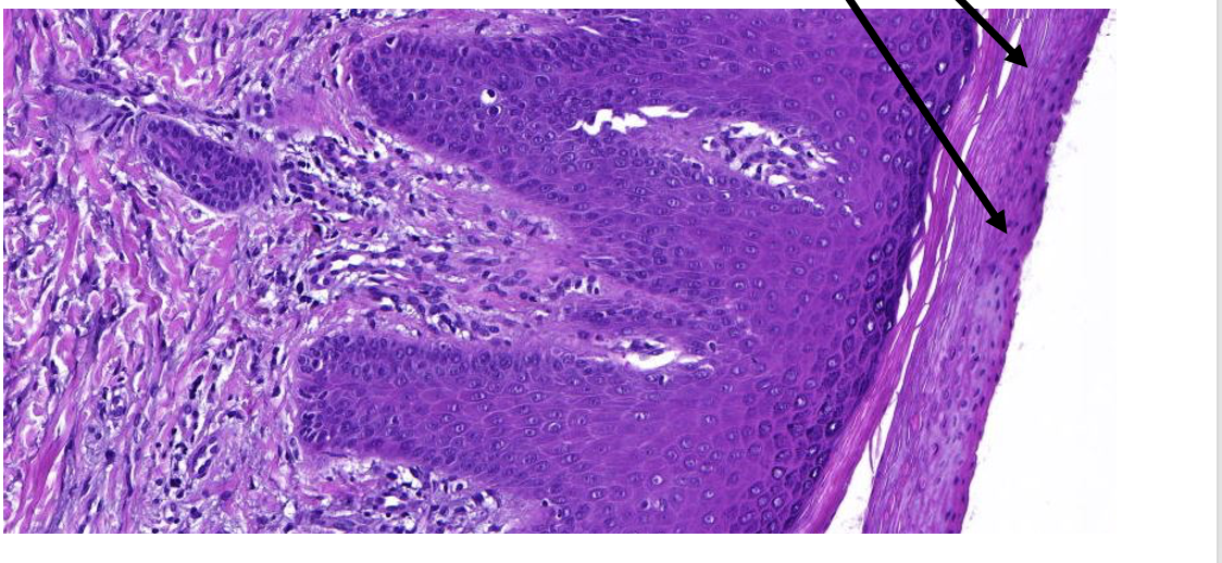 <p>Welk preparaat</p>