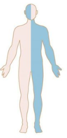 <p>Brainstem Lesion</p>