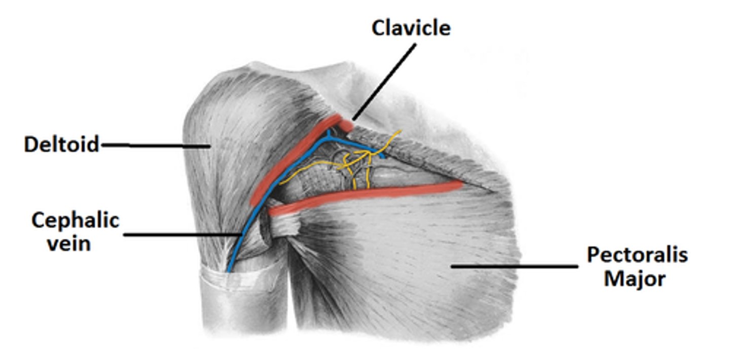 <p>clavicle (superior)<br>pectoralis major (medial) <br>deltoid (lateral)</p>