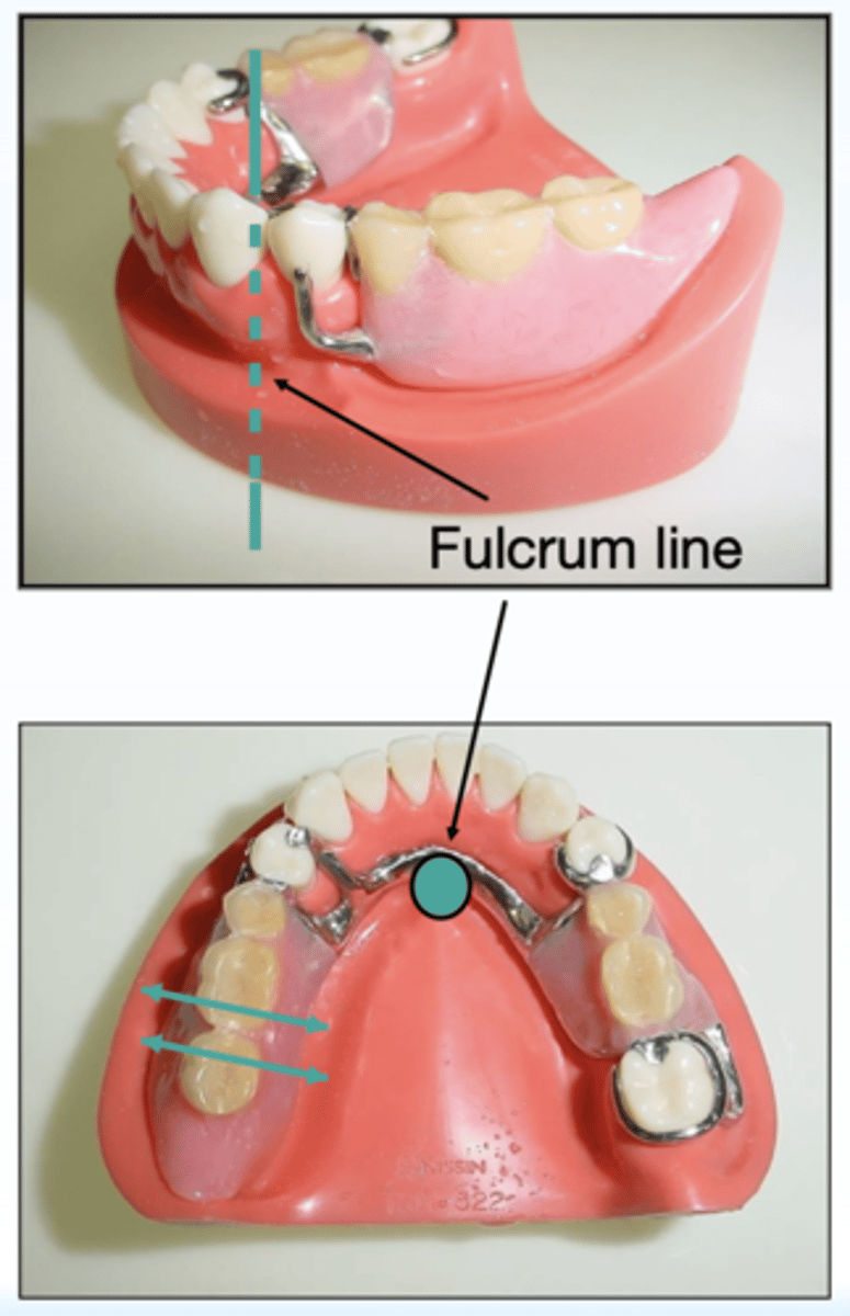 <p>ID the type of axis in teal:</p>