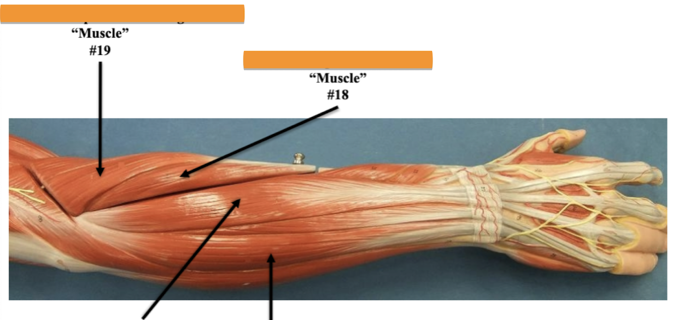 <p>Label muscle #18 </p>