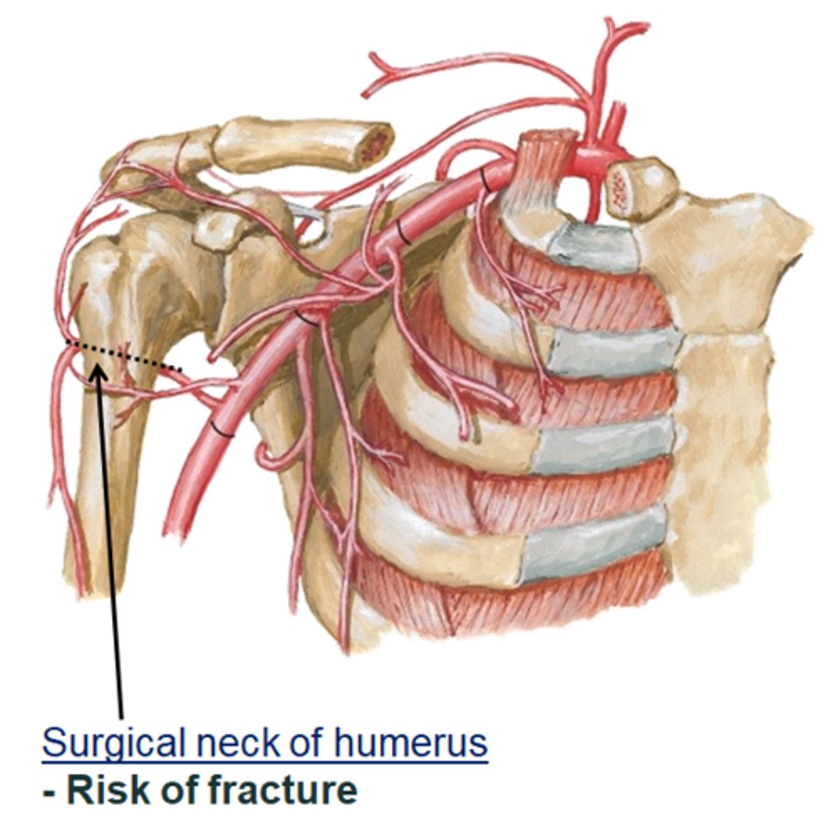 <p>axillary nerve wraps around the surgical neck. fracture of the surgical neck may damage the axillary nerve. Integrity of this nerve is tested by touching the deltoid, since the nerve provides sensory innervation to this area of the shoulder region</p>