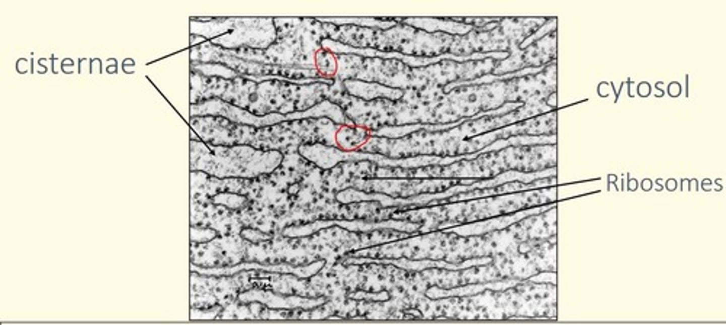 <p>• Associated with ribosomes </p><p>• Site of protein synthesis in the cytoplasm </p>