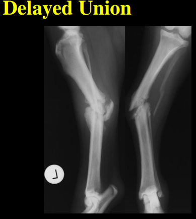 <p>Evaluation of fractures </p>