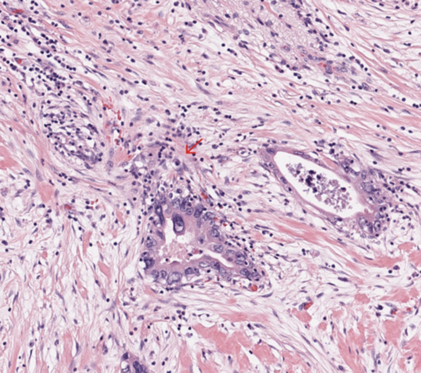 <p>Pancreas</p>
