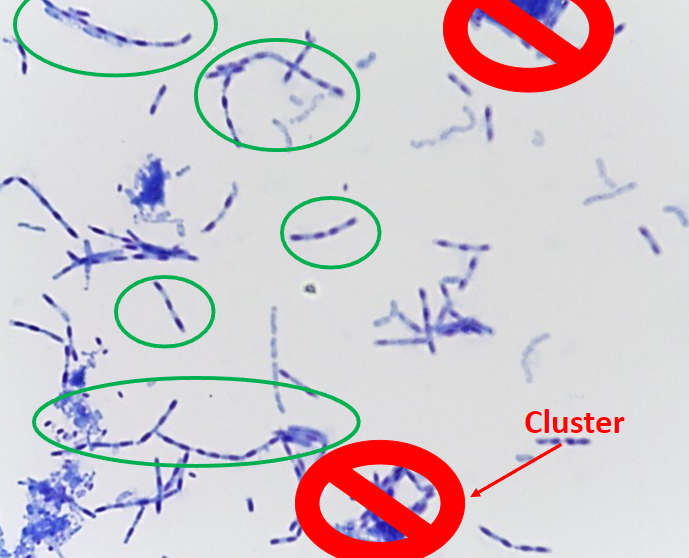 <p>What bacteria is this?</p>