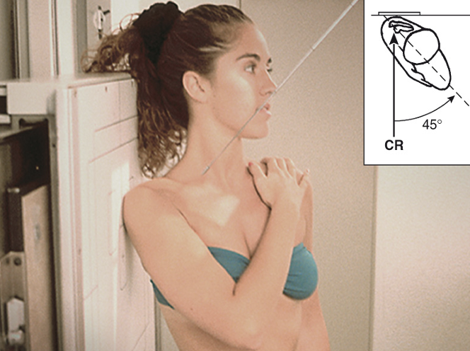 <p>Garth Method </p><ul><li><p>Apical oblique axial&nbsp;</p></li><li><p>45/45&nbsp;</p></li><li><p>IR is vertical&nbsp;</p></li><li><p>CR towards feet (caudal)</p></li></ul><p></p>