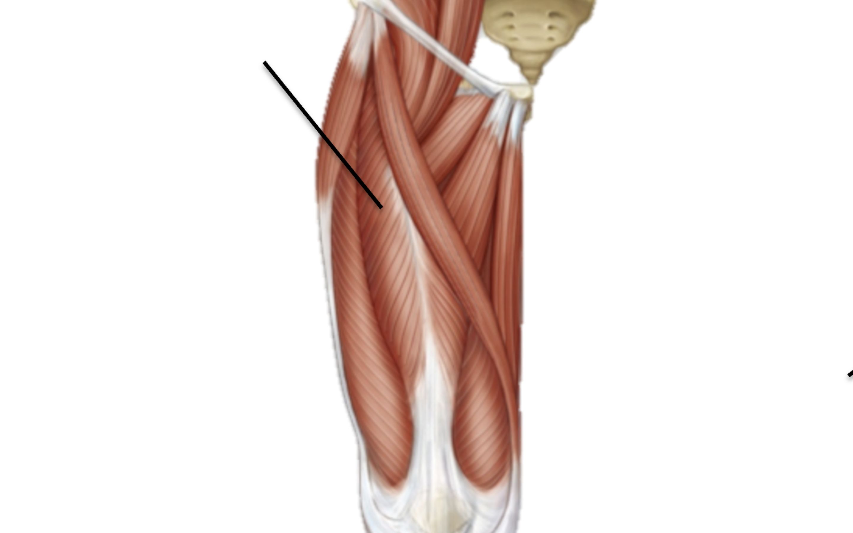 <p>What muscle is this?</p>