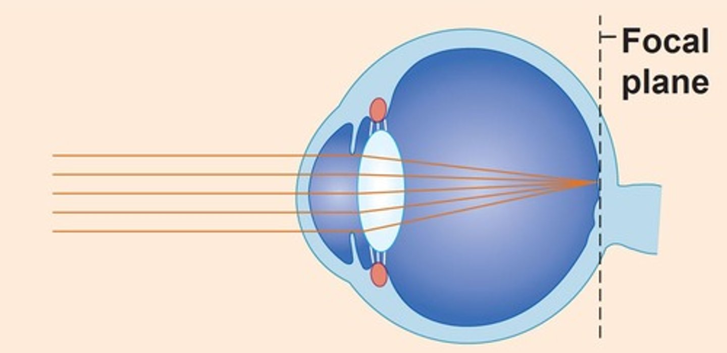 <p>Normal, focal point on retina</p>