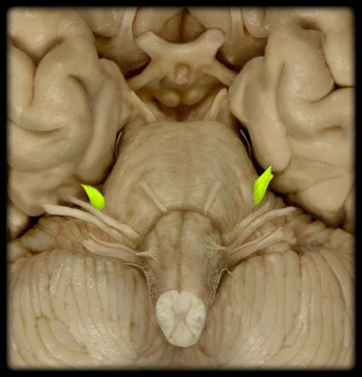 <p>Sensory: forehead, face, jaws (V1, V2, V3)</p><p>⚫ Supply dermatomes of face (Posterior region of the head via dorsal roots of cervical spinal nerves)</p><p>Motor: (V3) for motor outflow to the muscles of</p><p>mastication (chewing)</p><p>"Oh My Molars"</p>