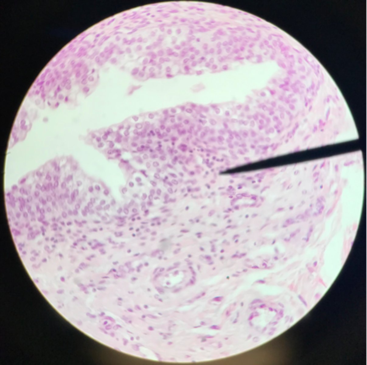 <p>What tissue is depicted on the slide above the pointer?</p>