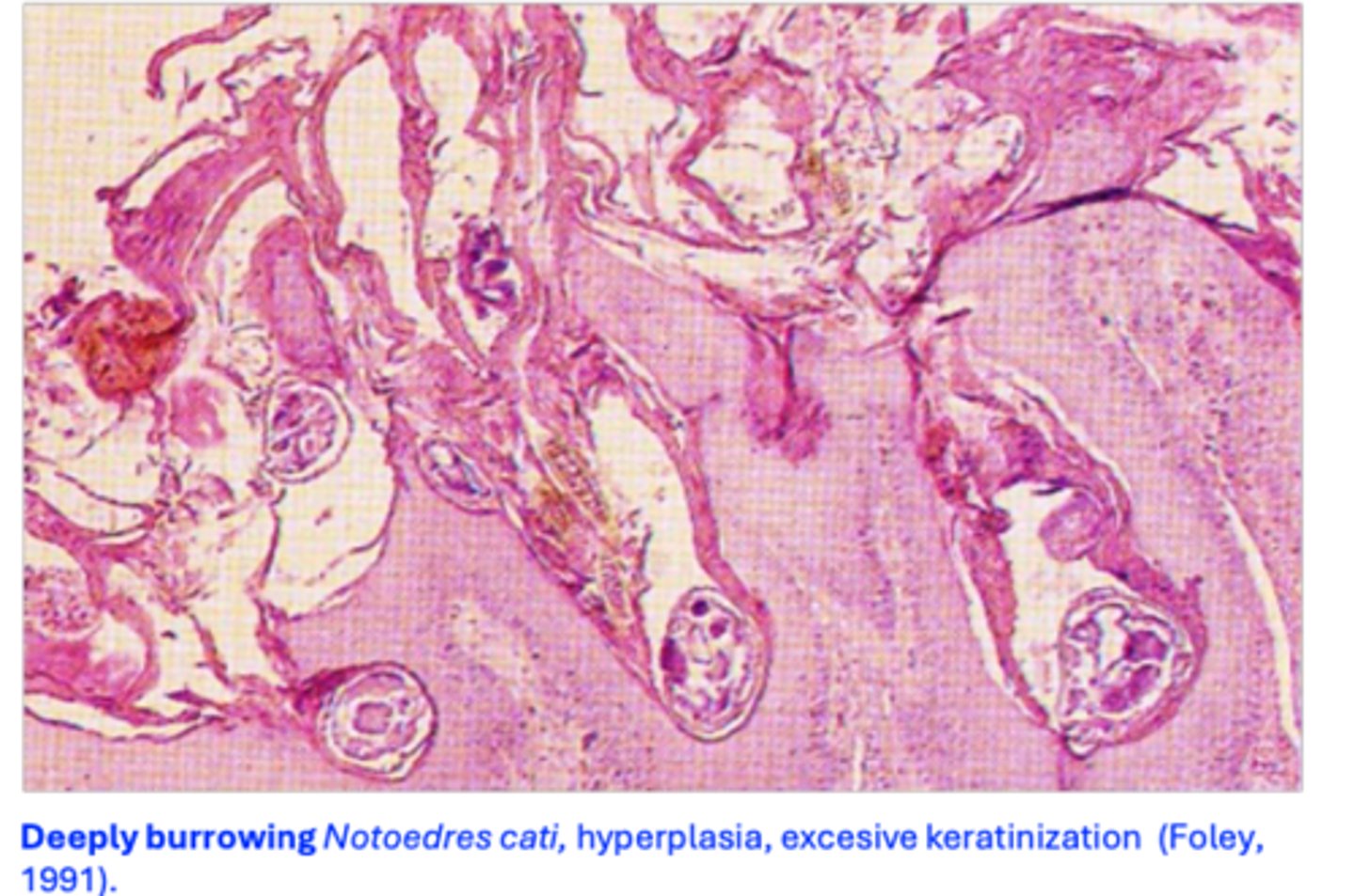 <p>Considered to be similar to that of Sarcoptes scabiei (egg, larva, two nymphal stages, adults);</p><p>Mites live in burrows in the epidermis;</p><p>Life cycle lasts 2-3 weeks;</p>