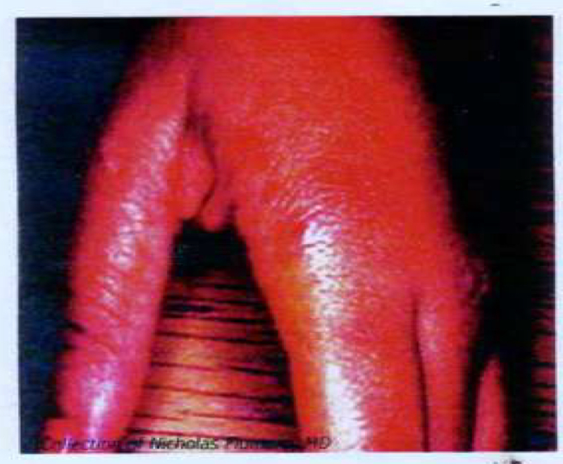 <p>Disease: caused by?</p>