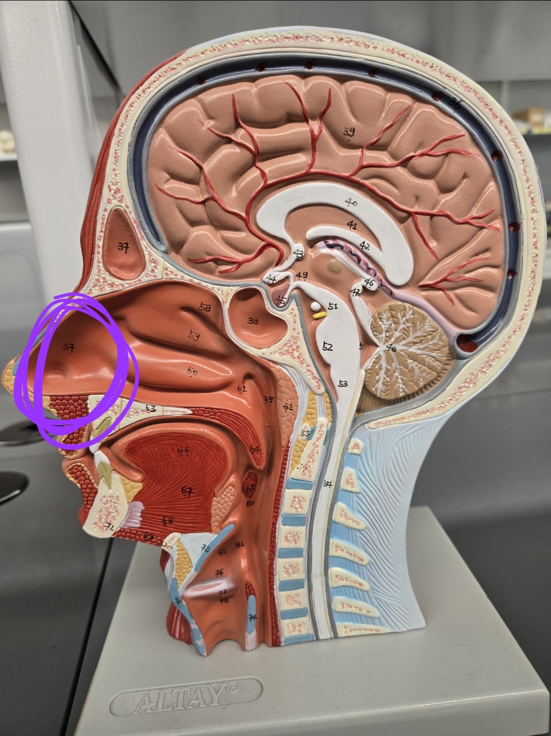 <p>Half head model: what structure is this?</p>