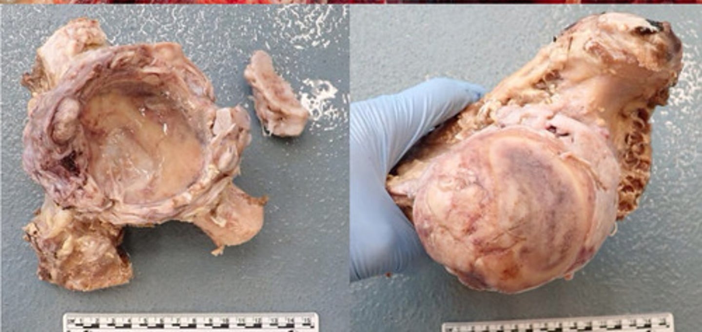 <p>Identify the pathology:</p>