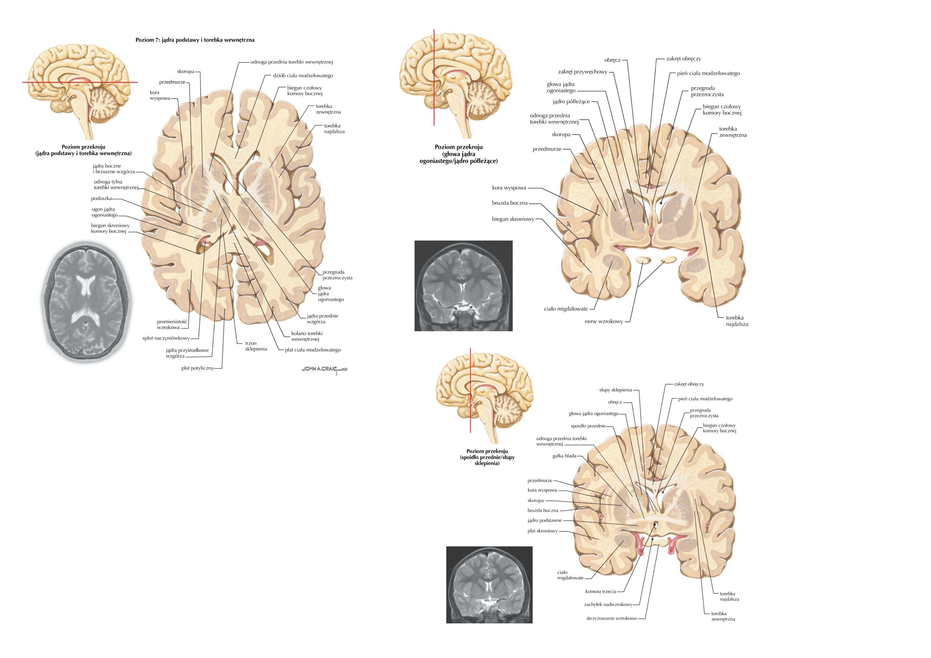 <ul><li><p>ciało prążkowane (corpus striatum)</p><ul><li><p>j. ogoniaste (caudate nucleus)</p></li><li><p>j. soczewkowate (lentiform nucleus) » gałka blada (globus pallidus)  i skorupa (putamen)</p></li></ul></li><li><p>przedmurze (claustrum)</p></li><li><p>ciało migdałowate (amygdaloid body)</p></li></ul>