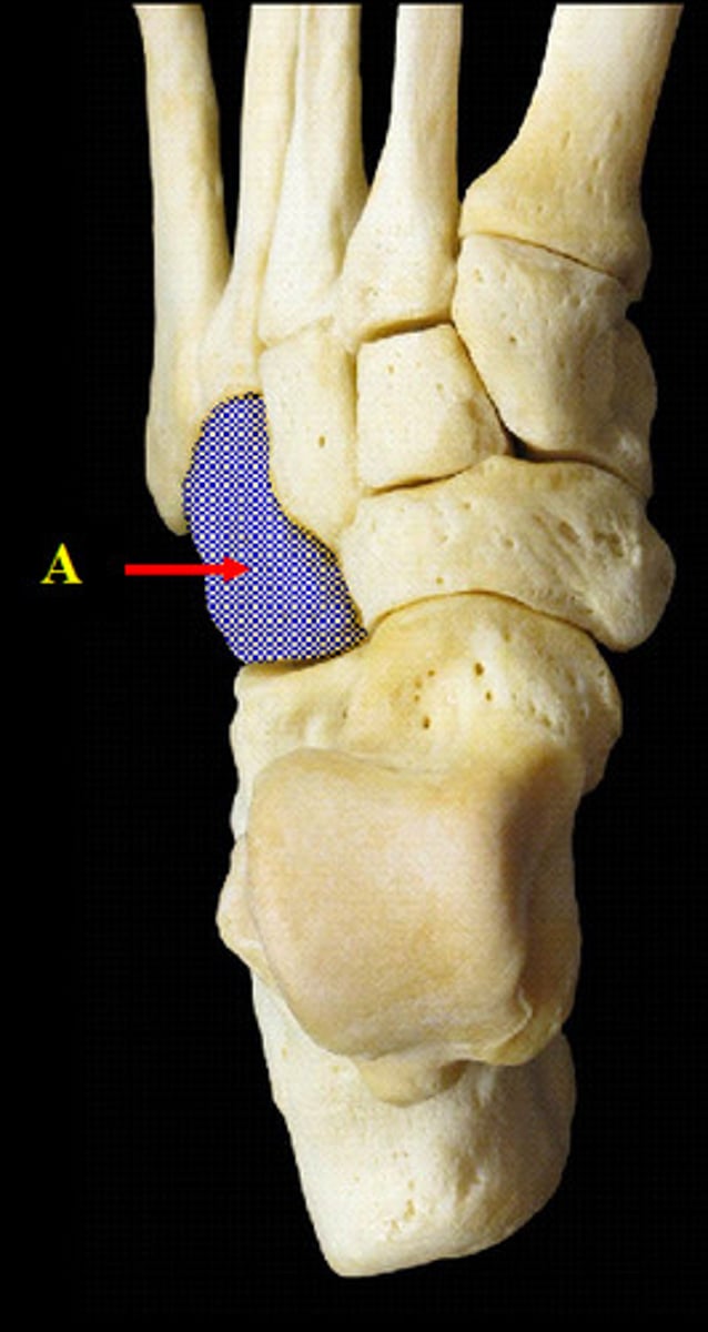 <p>Name the bone.</p>