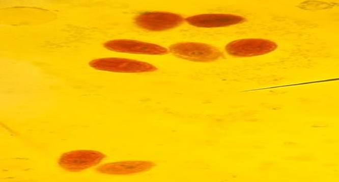 <p><strong>Identify the parasitic stage.</strong></p><p><strong>Mention the contents of this stage.</strong></p><p><strong>State the best method for diagnosing this disease.</strong></p>