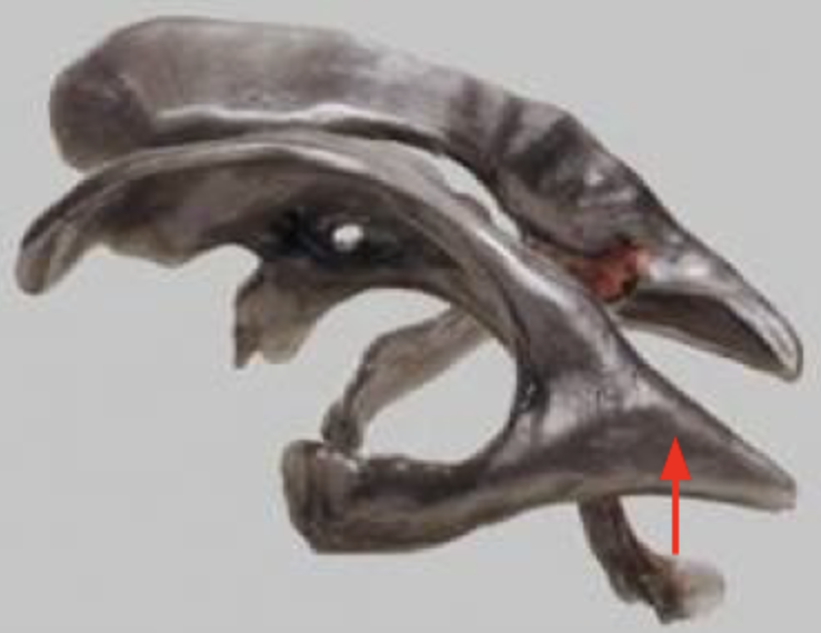 <p><span>What structure is indicated by the red arrow in this cast of the ventricular system of the human brain?</span></p>