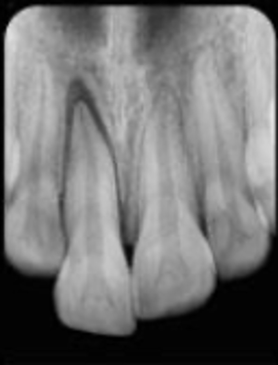 <p>Which trauma:</p>