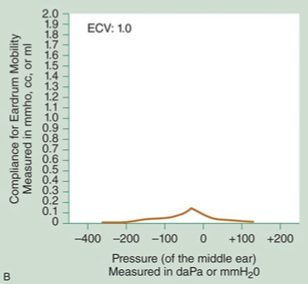 <p>what type of tympanogram is this? </p>