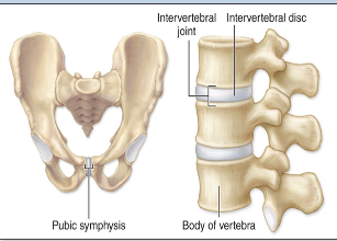 <p>Fibrocartilage pad between bones (this word means growing together)</p><p>ex: pubic symphysis; intervertebral disc articulations</p>