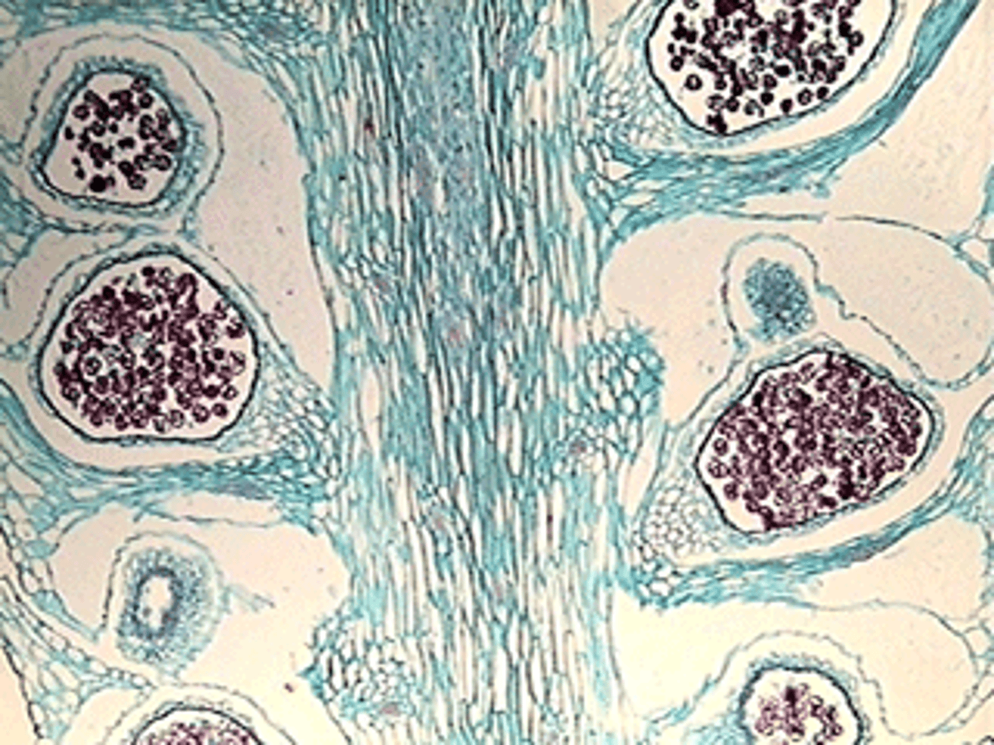 <p>Seedless Vascular</p><p>Phylum Lycophyta</p><p>homosporous</p>