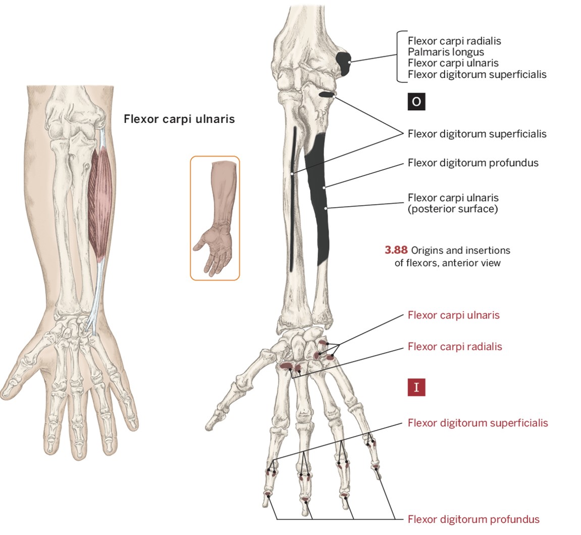 <p>O- Medial Epicondyle of the humerus</p><p>I- ( Anterior) Medial Carpals ( hook of hamate, pisiform, base of 5th metacarpal)</p><p>A- Wrist flexion &amp; Ulnar deviation</p>