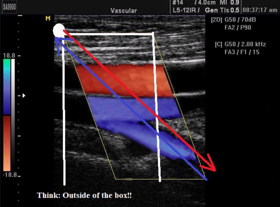 <p>describe the blood flow occurring in this image</p>