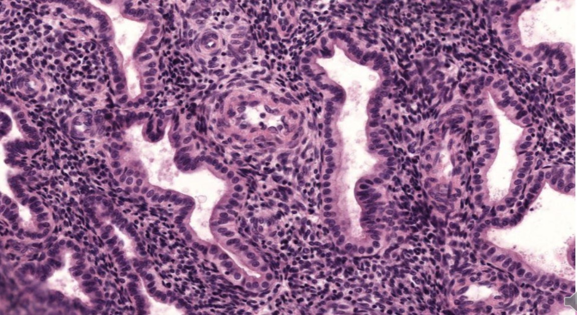 <p>Epitelio monoestratificado cilíndrico útero</p>