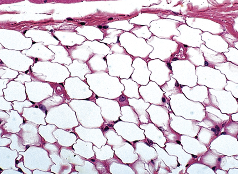 <p>Adipose tissue (white):</p>