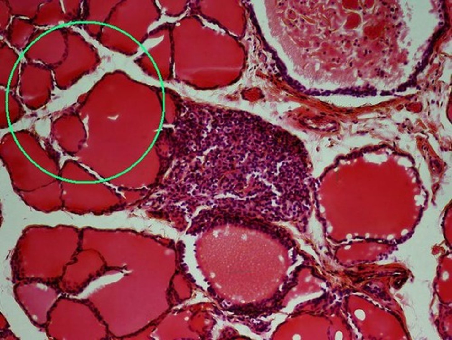 <p>thyroid gland</p>