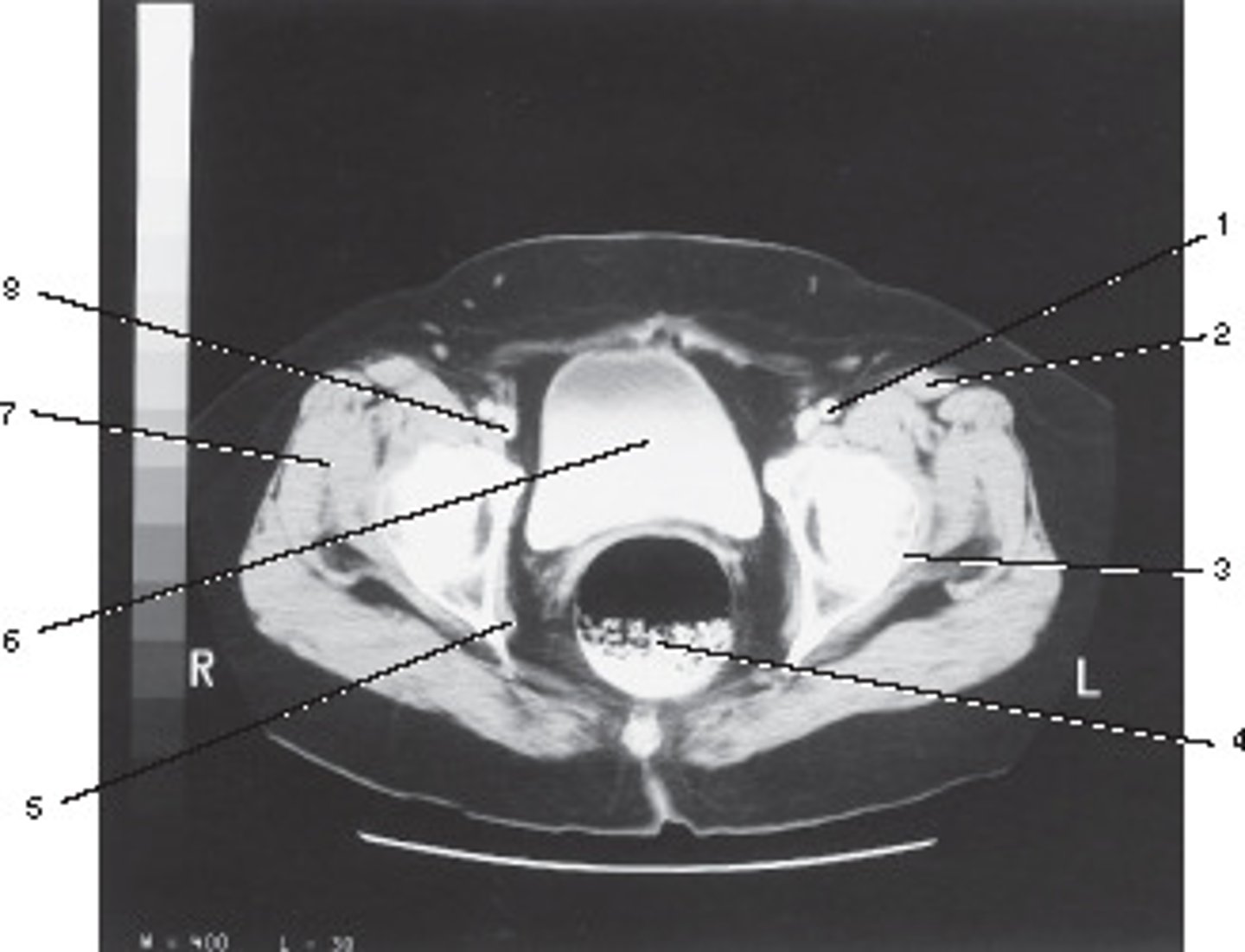 <p>Number 1 corresponds to which of the following?</p>