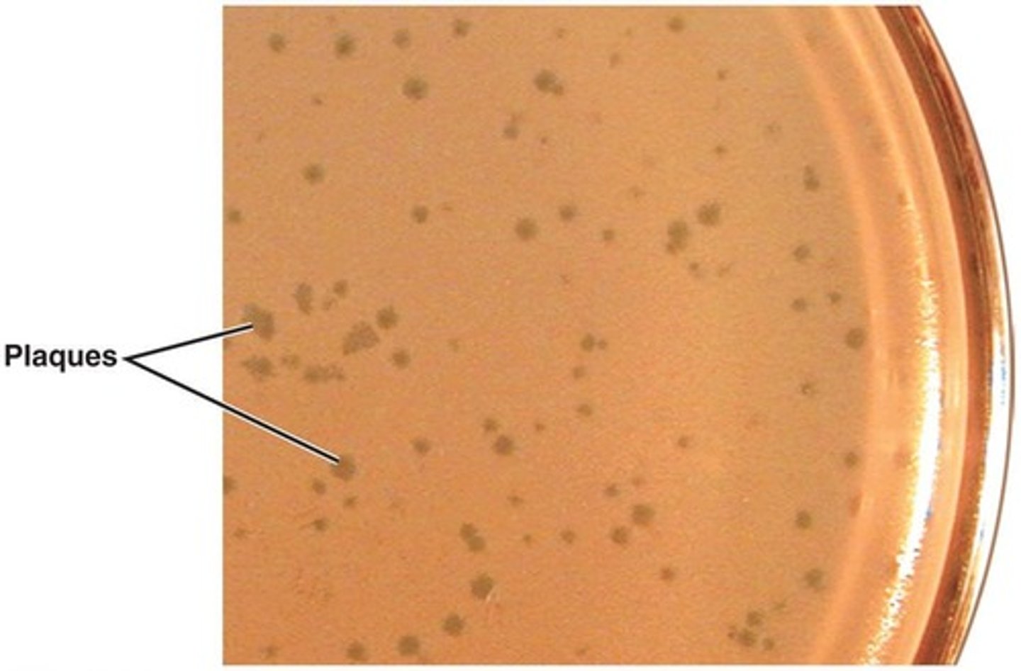 <p>Clearings on a lawn of bacteria on the surface of agar formed by bacteriophages.</p>