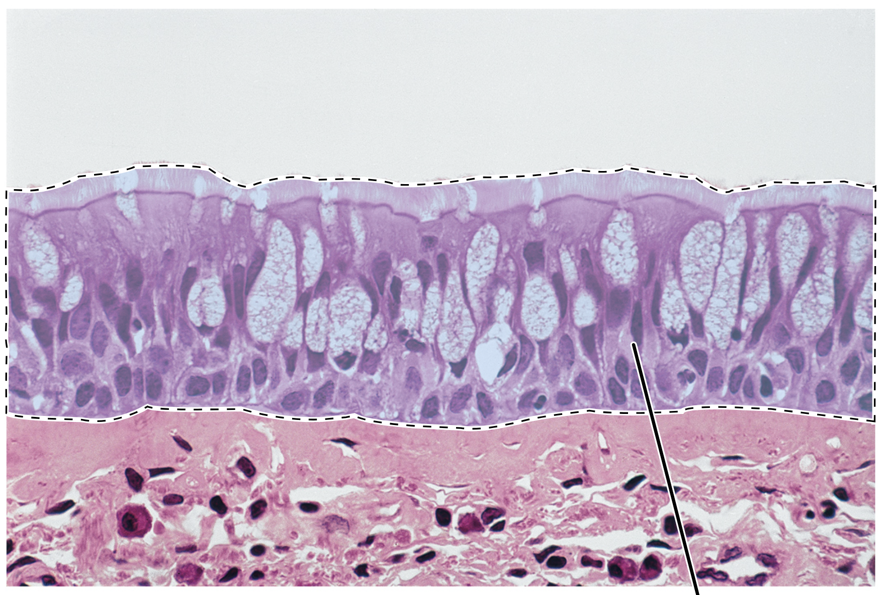 <p>Name the highlighted tissue.</p>