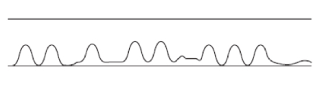 <p>Welke ademhaling zie je hier</p>