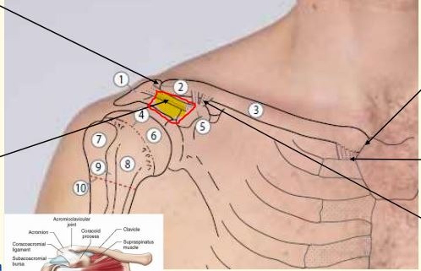 <p>Coracoacromial ligament</p><p>- Supports shoulder joint superiorly</p><p>- Can be ruptured by superiorly directed forces</p><p>- Can impinge on supraspinatus/subacromial bursa</p>