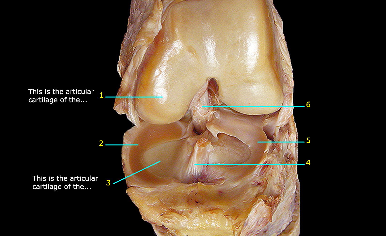 <p>What structure is labeled 4?</p>