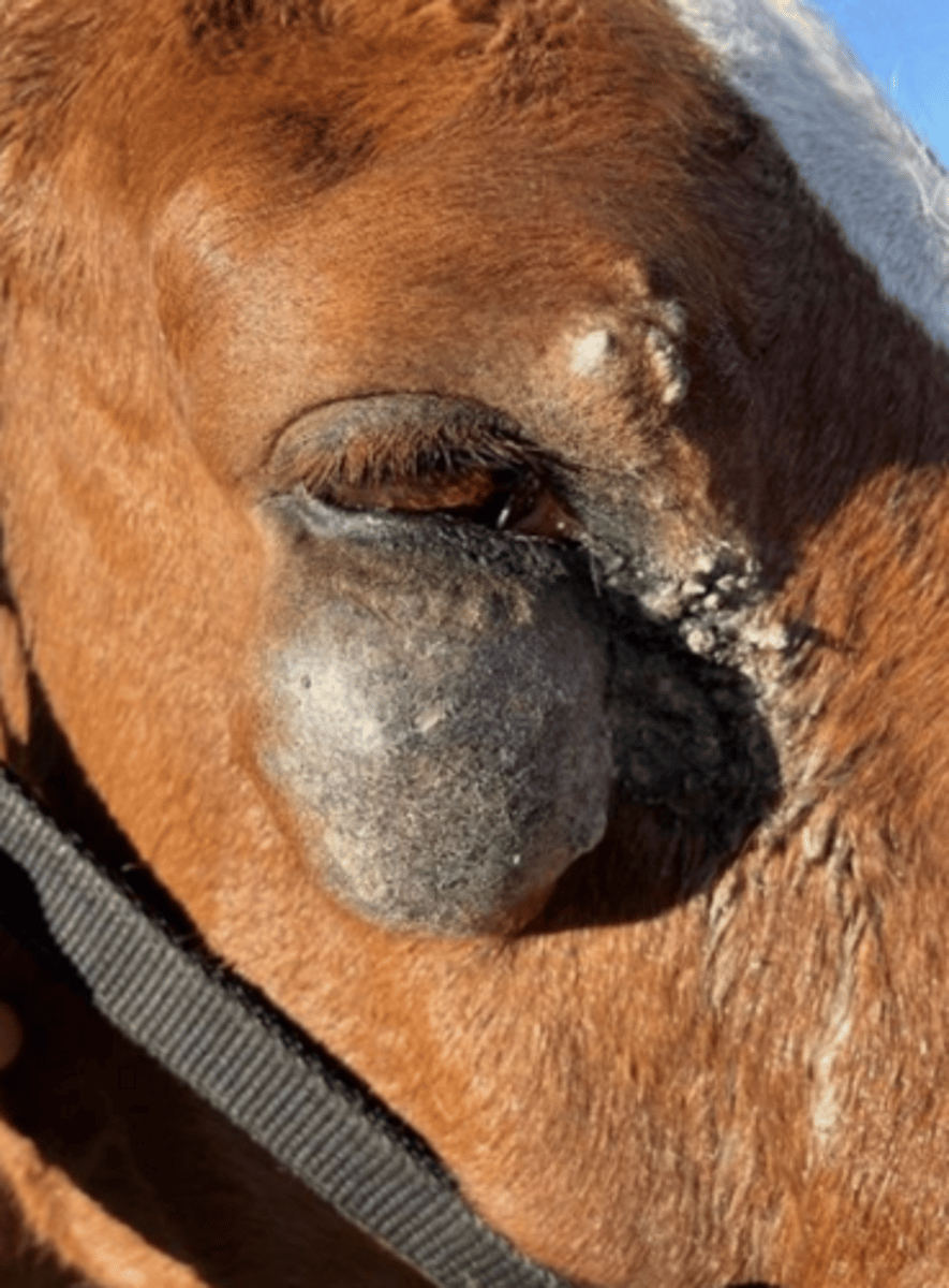 <p>What is the most likely diagnosis for this presentation?</p>