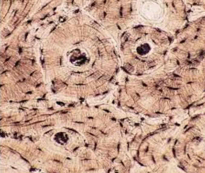 <p>Like the rings on a tree trunk when cut, circular</p>