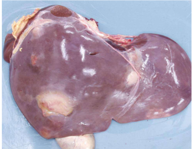 <ol><li><p><strong>Species and organ-</strong> bovine liver</p></li><li><p><strong>Describe using 3 words- </strong>multi focal, round lesions of whitish color</p></li><li><p><strong>Potential diagnosis- </strong>liver abscess</p><ol><li><p>May have few clinical signs</p></li><li><p>Extension into vena cava= severe consequences with multiple septic foci in lungs</p><ol><li><p>Vena cava syndrome</p></li></ol></li><li><p>Fragments of tyre wire which may contaminate silage when infested can penetrate reticulum and migrate into liver and cause abscess with peritonitis/reticulitis</p></li></ol></li><li><p><strong>Judgement- </strong>local rejection</p><ol><li><p>Total if septic complications</p></li></ol></li><li><p><strong>Advice to the farmer</strong></p><ol><li><p>Make sure no debris in feed</p></li></ol></li></ol><p></p>