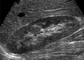 <p>Is the kidney imaged from an adult, child, neonate, or fetus?</p>