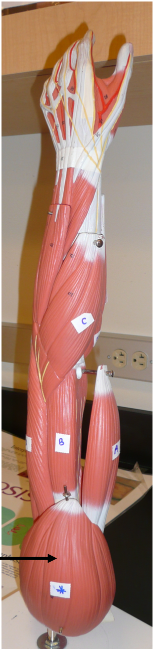 <p>The muscle on the arrow is the prime mover of </p><p></p><p>A. arm flexion</p><p>B. arm extension</p><p>C. arm adduction</p><p>D. arm abduction</p>