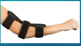 <p><strong>Cubital Tunnel Syndrome: Clinical Diagnosis and Treatment</strong></p><p>-S/S: </p><ul><li><p>Parathesias of the ___ and ___ digits </p></li><li><p>Medial elbow ____, aggravated by elbow _________</p></li><li><p>+ ____ sign possible </p></li></ul><p>-Diagnosis: </p><ul><li><p>Motor and sensory nerve conduction studies</p></li><li><p>___ and/or US</p></li></ul><p>-Treatment: </p><ul><li><p>Activity modification</p></li><li><p>________ elbow </p></li><li><p>Severe or refractory symptoms = ________________ surgery </p></li></ul><p></p>