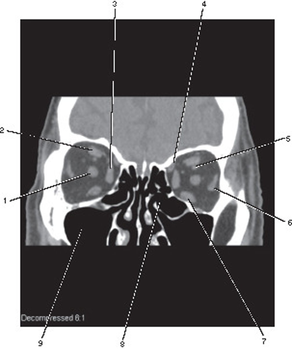 <p>Number 1 corresponds to which of the following?</p>